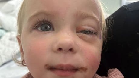 'I thought my baby was scared of the dark - then we got devastating diagnosis'
