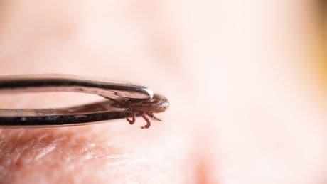 Zecken entsorgen: Welchen Fehler Sie unbedingt vermeiden müssen