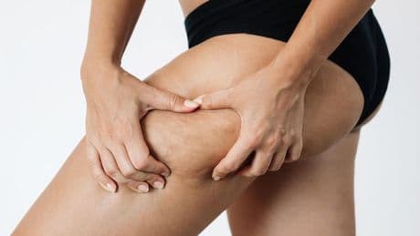 Miren García-Chazarra, experta en tecnobelleza: “El cepillado en seco, al mejorar la circulación sanguínea y linfática, reduce la acumulación de líquido en el tejido, ayudando a prevenir y tratar la celulitis”