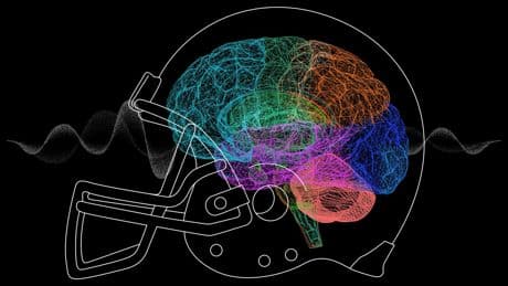 NFL and UFC athletes try 'game-changing' psychedelic to treat brain injury