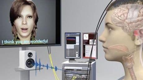 18 yıl sonra konuştu: Felçli hastaya yapay zeka destekli beyin implantı yapıldı