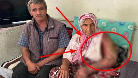 8 yıl önce kolu şişti, ödem topladı! Tanı bile konulamadı: Çaresiz kadın yardım bekliyor
