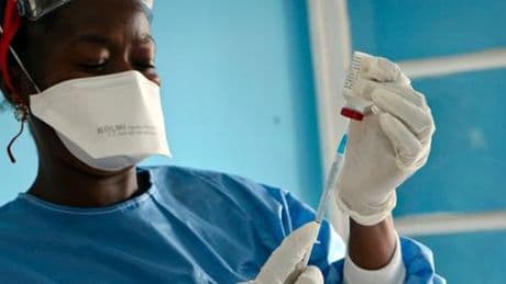 Demokratische Republik Kongo: Mindestens 15 Tote bei neuem Ebola-Ausbruch