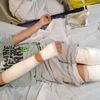 Waalse Élio (7) zwaargewond na contact met invasieve plantensoort