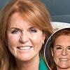 Sarah Ferguson's changing face: How the Duchess was a 'guinea pig' for new cosmetic treatments