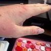 Hotel guest who was bitten 30 times by bed bugs in infested room tells how she woke up to see them 'crawling on the bed'