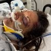 Montreal cyclist says ‘miracle’ she’s alive after hitting pothole, goes into coma