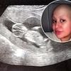 Mother-to-be thought her extreme morning sickness was down to her pregnancy - only to receive devastating cancer diagnosis