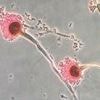 Deadly fungus that 'eats you from the inside out' invades US: 'Hundreds of thousands of lives at risk'