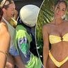 Influencer slammed for riding a scooter without a helmet after brain aneurysm and multiple surgeries: 'It makes my blood boil'