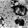 Arizona resident dies from plague, health officials say