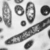 Death toll from Legionnaires' disease outbreak in New York City rises to 7