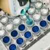 Could aluminium become the packaging 'champion'?