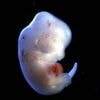 Menschliche Herzen aus dem Schwein: Forscher züchten chimäre Embryos für Organtransplantation