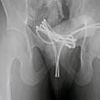 Man, 21, hospitalised due to risky 'sounding' sex act involving a USB cable