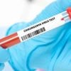 Chikungunya à La Réunion : une étude sera lancée le 25 août pour mesurer l’immunité de la population