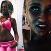 Tanning addict, 18, who uses sunbeds four times a week, reveals worrying signs of UV damage on her body - but admits she still can't kick the habit