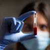 Cancer : NovaGray évalue la tolérance à la radiothérapie avec une simple prise de sang