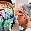 The little known warning sign that could mean you are MORE at risk of developing dementia