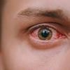 Urgent warning issued as drug chiefs recall common eye drops due to risk they could cause BLINDNESS