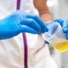 Envahies de bouteilles d’urine non sollicitées, ces cliniques sont obligées de hausser le ton
