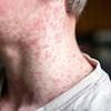 Doctors issue urgent warning after world's most infectious disease kills child in Liverpool - more deaths 'a tragic inevitablity'