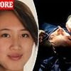 I spent $120k on 14 plastic surgeries: These are the common procedures I regret... and one that stopped me closing my eyes for FIVE YEARS
