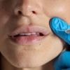 AI tool put to test sifting public views on botox and fillers