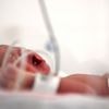 Des erreurs de prise en charge évitables parmi les multiples causes de la mortalité infantile en France