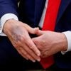 US-Präsident leidet an Venenschwäche: „Patienten in einem frühen Stadium sollten auf jeden Fall Sport machen“