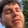 Man diagnosed with skin cancer at just 26 reveals the telling sign he had the disease... which he almost overlooked