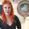 Mum who lost 4st in five months on Mounjaro issues urgent warning after her eyes turned yellow and she needed an organ removed