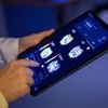 Doktor Computer: Gesundheitsumfrage: Ein Viertel nutzt KI zur Selbstdiagnose