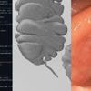 eHealth: Coden und KI in der Gastroenterologie & wo bislang der Durchbruch fehlt