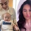 I was left with second-degree burns after a baby bottle exploded on my chest