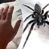 Australian spider with an 'excruciating bite' arrives in Britain: Cotswolds tourist is left with a hand 'like a balloon' after encounter
