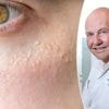 “Scrubs verhelpen ze absoluut niet”: wat zijn gerstekorrels en hoe krijg je ze weg?