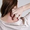 Subtle signs on your skin and neck that mean you could have deadly condition suffered by 100m