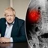 BORIS JOHNSON: I've just had private healthcare and here's why I'm not ashamed to admit it