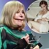 Kim Novak, 92, looks almost unrecognisable as she receives the Golden Lion for lifetime achievement at the Venice International Film Festival