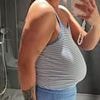 Mother-of-one, 27, crippled by her 36K breasts forced to pay for own reduction op after the NHS refused