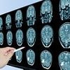 The hidden ingredient in your food and clothes that explains rise of dementia in US