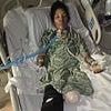 Terrified mom wakes up with all of her limbs amputated after catching two common infections at the same time