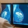 New test taken two weeks after starting treatment for breast cancer can tell if the disease is likely to return