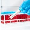 Verenigd Koninkrijk introduceert eerste gonorroe-vaccin