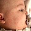 Vaccination plea after baby's 'terrifying' measles