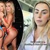 Cavinder twins post update on their recovery from boob-job surgery after going under the knife together