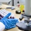 Mieux diagnostiquer la maladie cœliaque grâce à un test sanguin prometteur