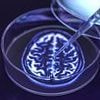 SMALL CAP IDEA: Ixico embraces AI for new Alzheimer's treatments