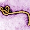 Einsatzkräfte müssen ausrücken: Mann in Tschechien könnte mit Ebola infiziert sein